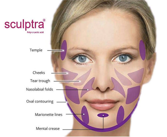 Sculptra PLLA collagen filler for clinic use and wholesale
Authentic Sculptra injectable for long-lasting facial volume